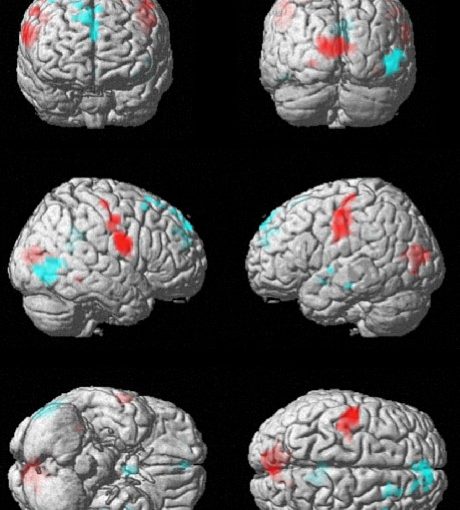 Neurophysiologie des Simultandolmetschens | Neurophysiology of simultaneous interpreting – by Eliza Kalderon